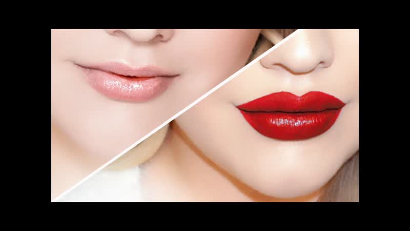 MY LIP INJECTIONS,