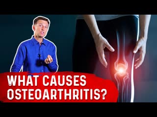 The Bacteria in Mouth is Linked to Osteoarthritis  Dr. Berg