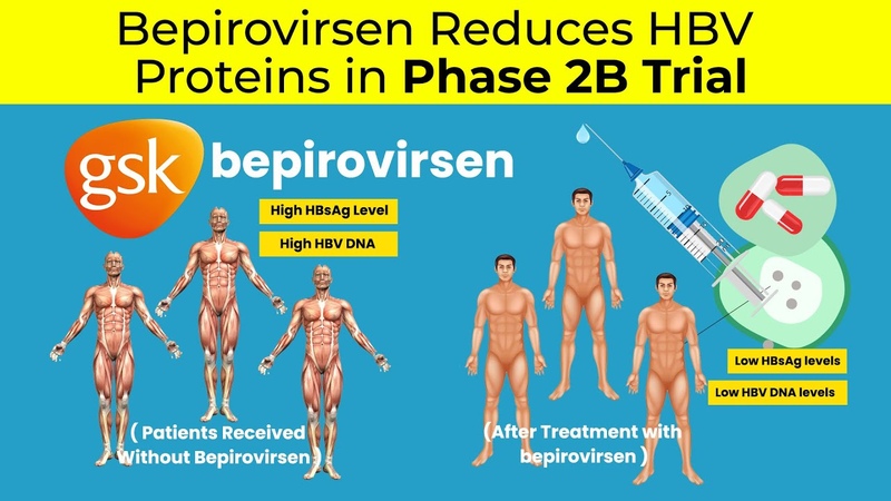 Bepirovirsen Reduces HBV Proteins in Phase 2 B Trial, Bepirovirsen Clinical Trial, Fatty