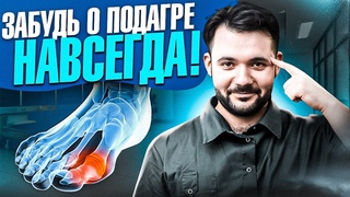 Как вылечить ПОДАГРУ Самый эффективный способ