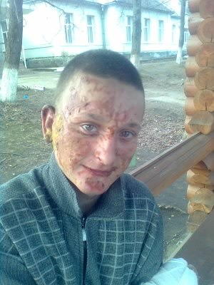 Анзор Хапов Анзоравич | Псков