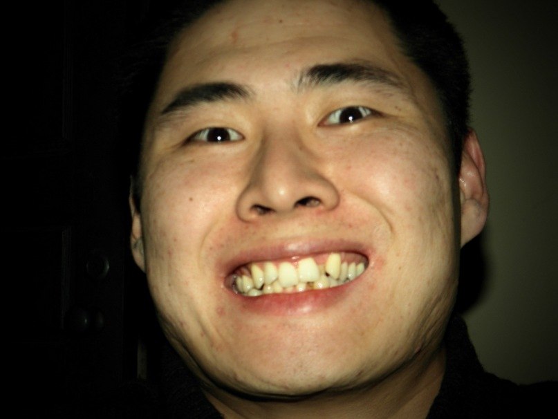 Евгений Мушаев | Элиста