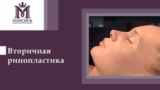 Максим Иванчук:  Как изменилась моя внешность! Секреты вторичной ринопластики