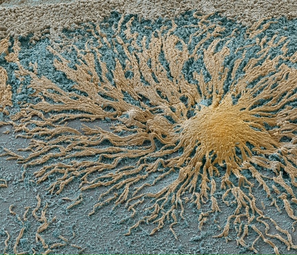 LOOK: Award-Winning Microscopic Images Science images, Microscopic photography,